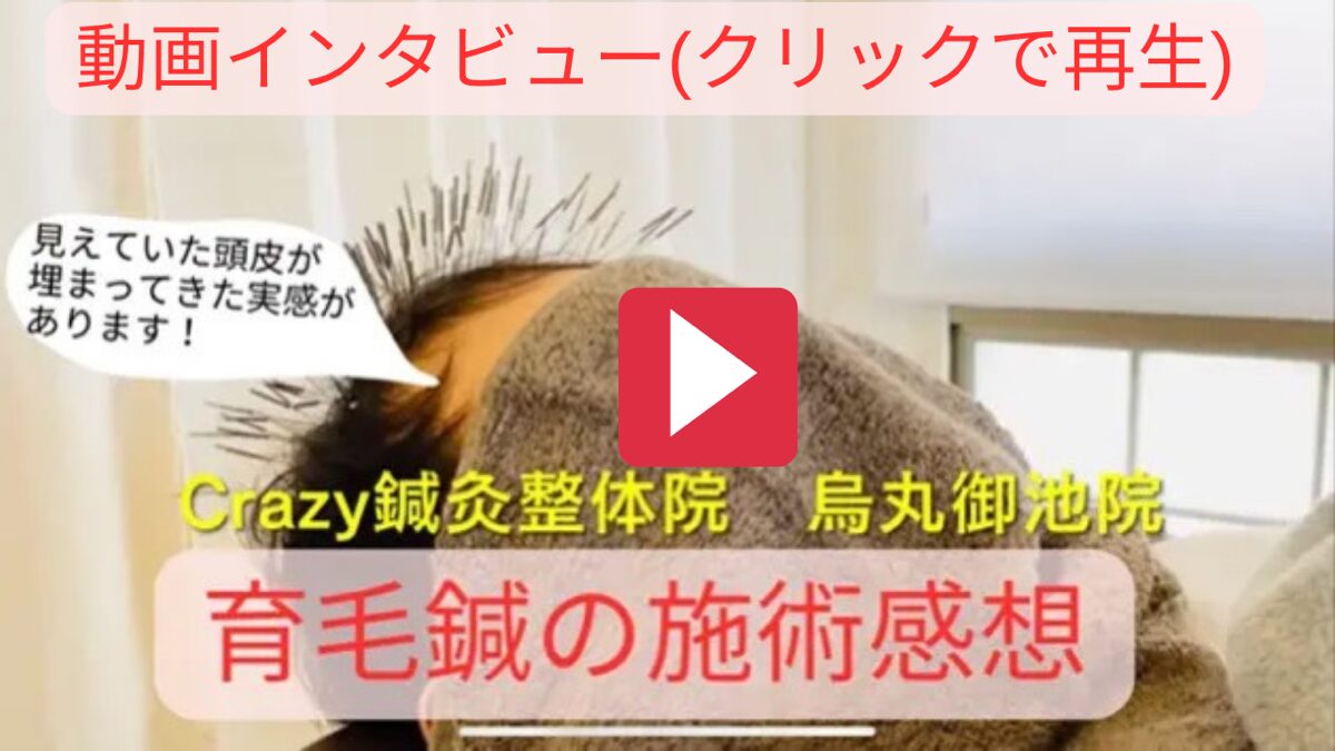 抜けた髪…見えていた頭皮が“埋まってきた”！