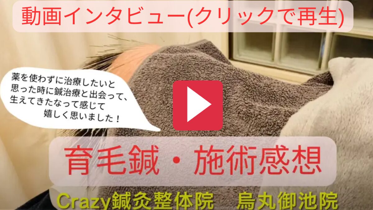 色々試してもダメだったけど…鍼で前髪に“生えてきた実感”！